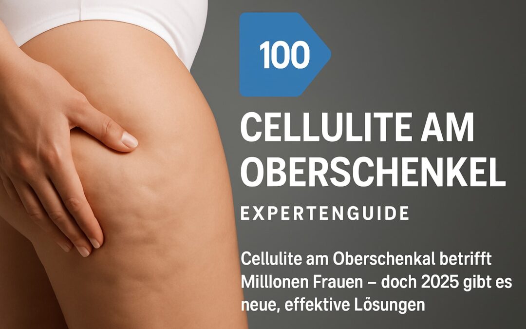 Cellulite Am Oberschenkel: Der Experten-Guide 2025
