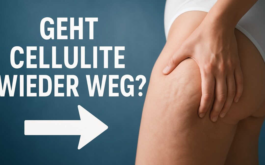 Geht Cellulite Wieder Weg: Der Umfassende Guide 2025